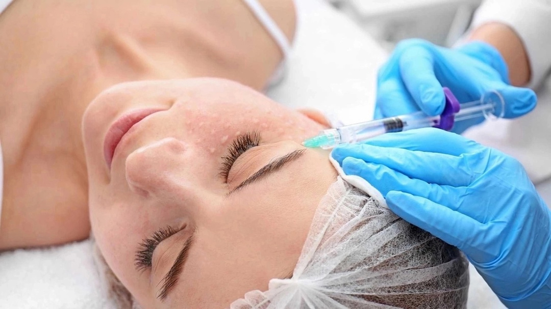 Биоревитализация