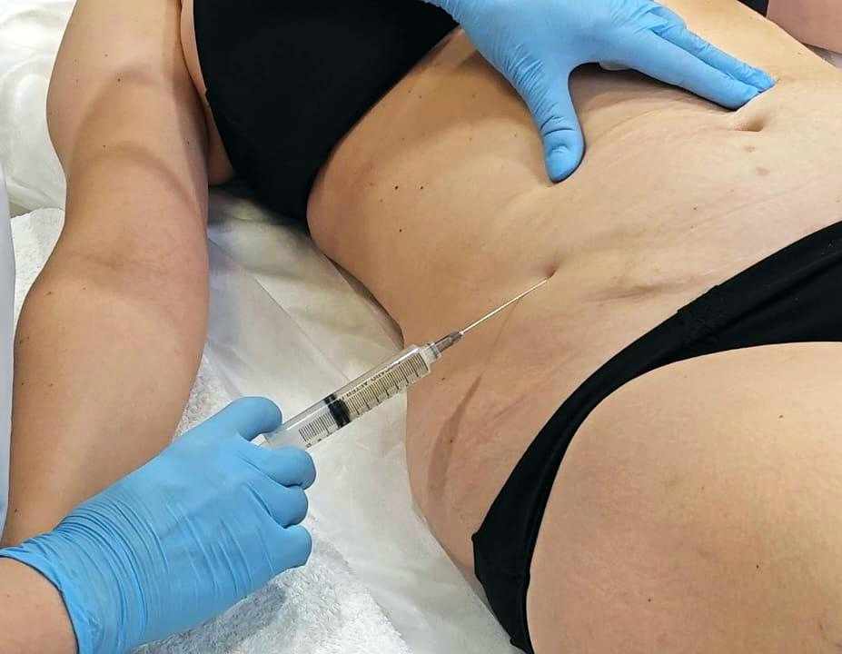 Липолитики