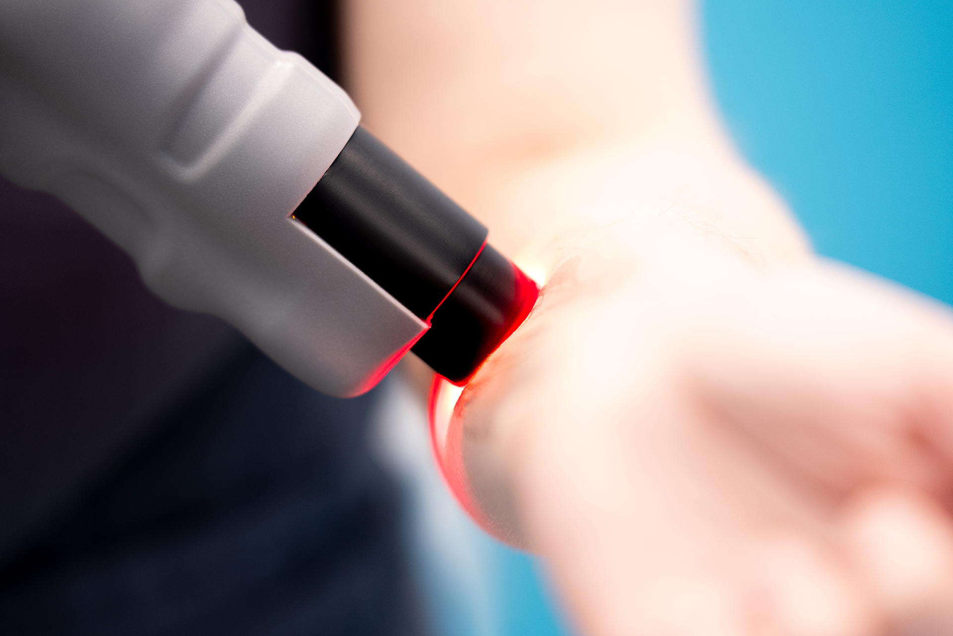 Лазерное оборудование